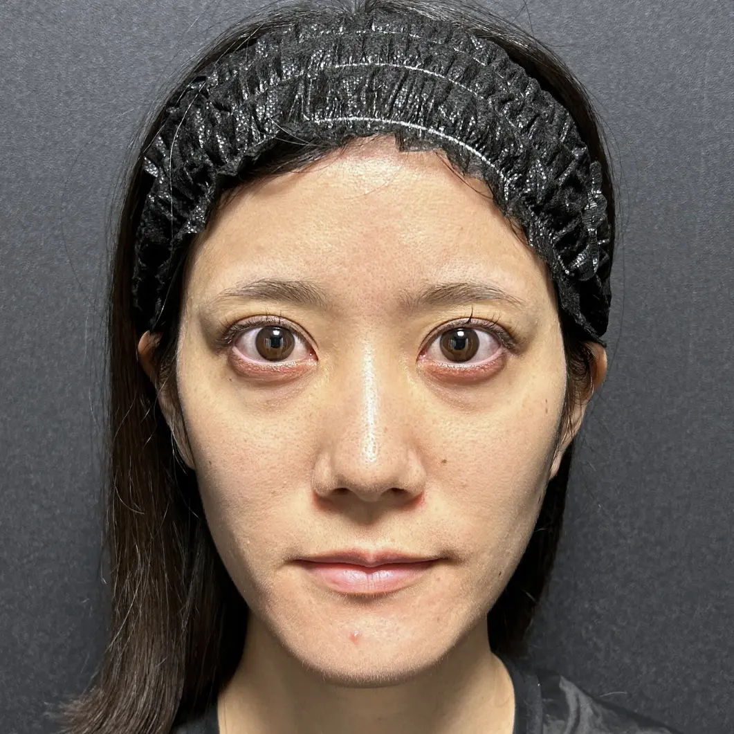 施術前