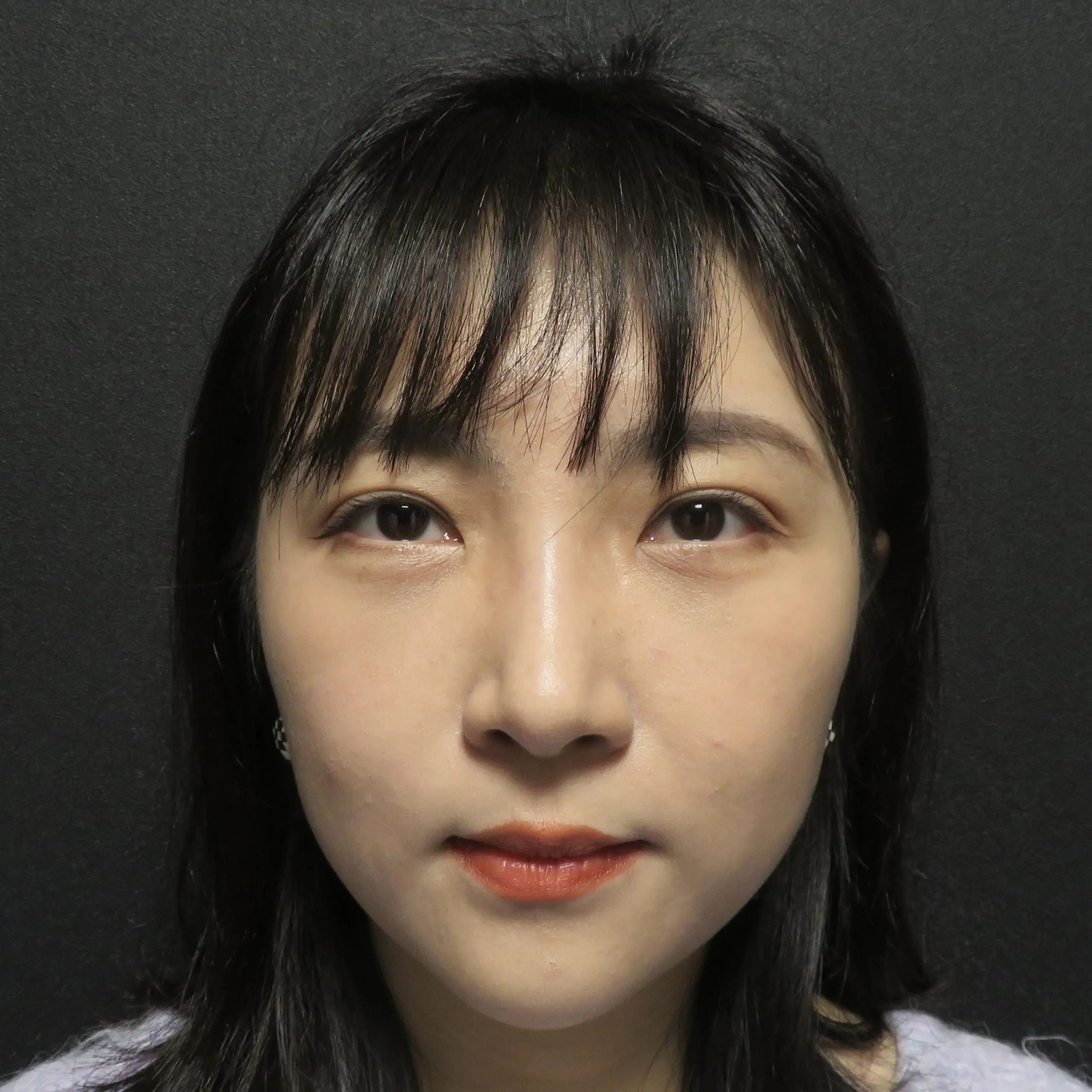 施術後