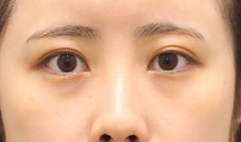 施術前