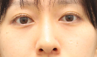 施術後