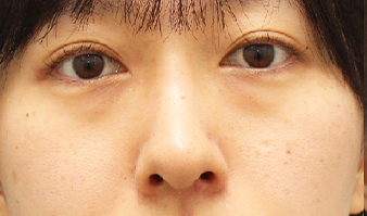 施術前