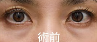 施術前