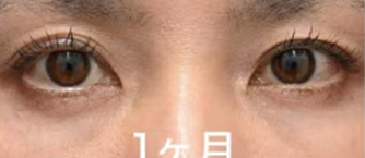 施術後