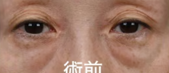 施術前