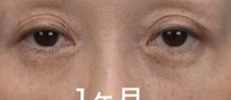 施術後